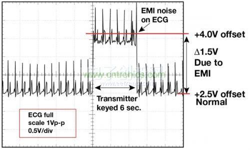 1.5 英尺以外的發(fā)射器（f = 470 MHz, P= 0.5W）開(kāi)啟和關(guān)閉時(shí)ECG 診斷設(shè)備的心臟檢查結(jié)果