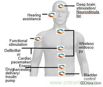 植入無線電應(yīng)用示例
